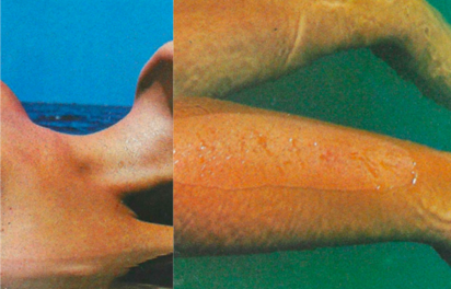 NAPA e Jovem Dionisio revelam “Amor de Novo”